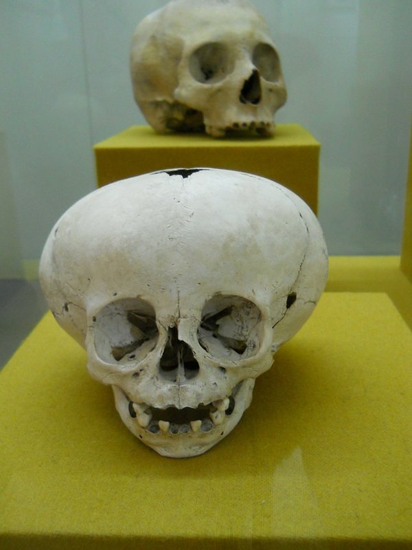 Deformed Mayan Skull