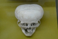 Deformed Mayan Skull