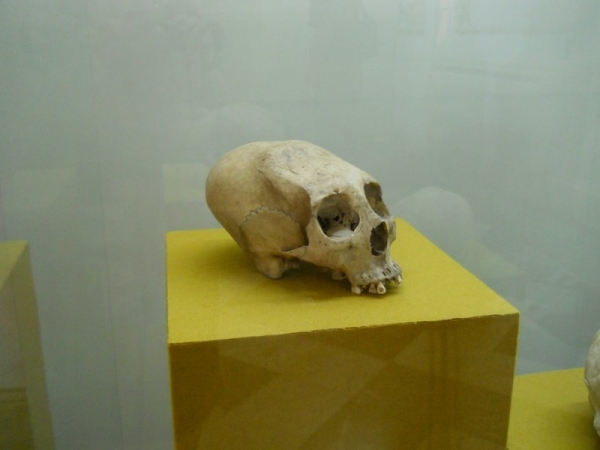 Mayan Skull Deformation